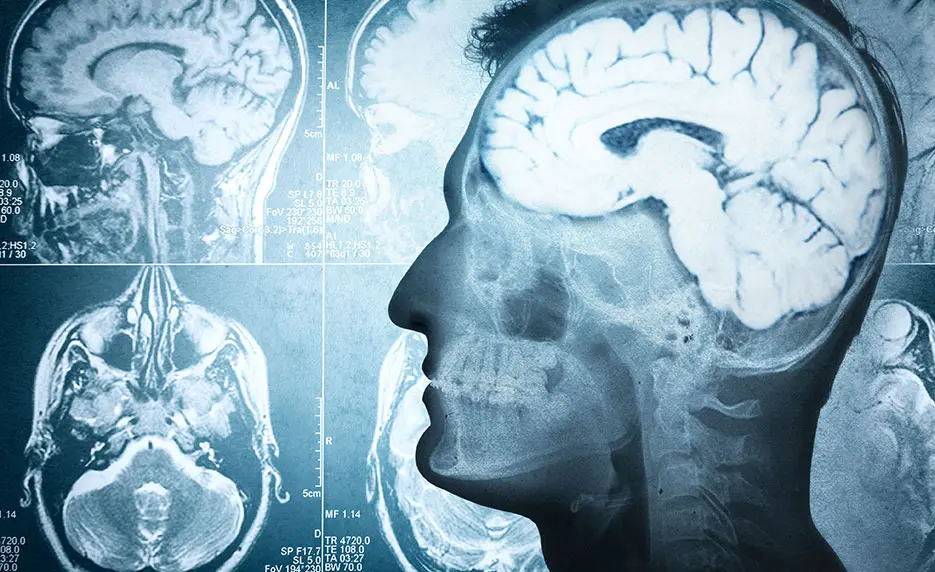 online training brain health